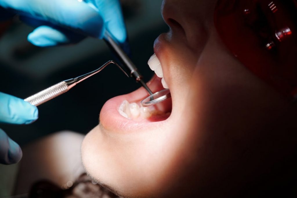 Image of An Open Mouth of a Person